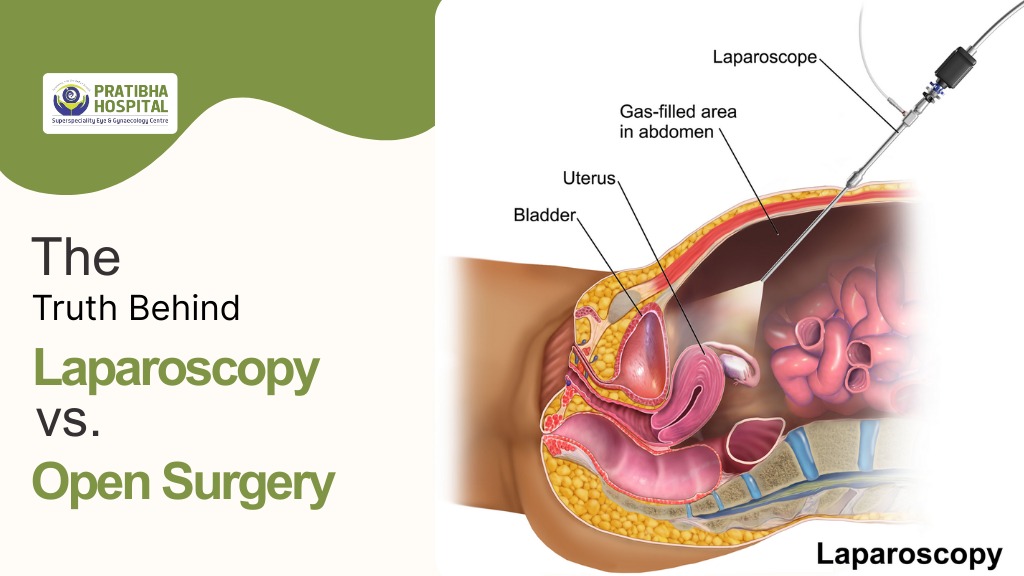 The Truth Behind Laparoscopy vs. Open Surgery